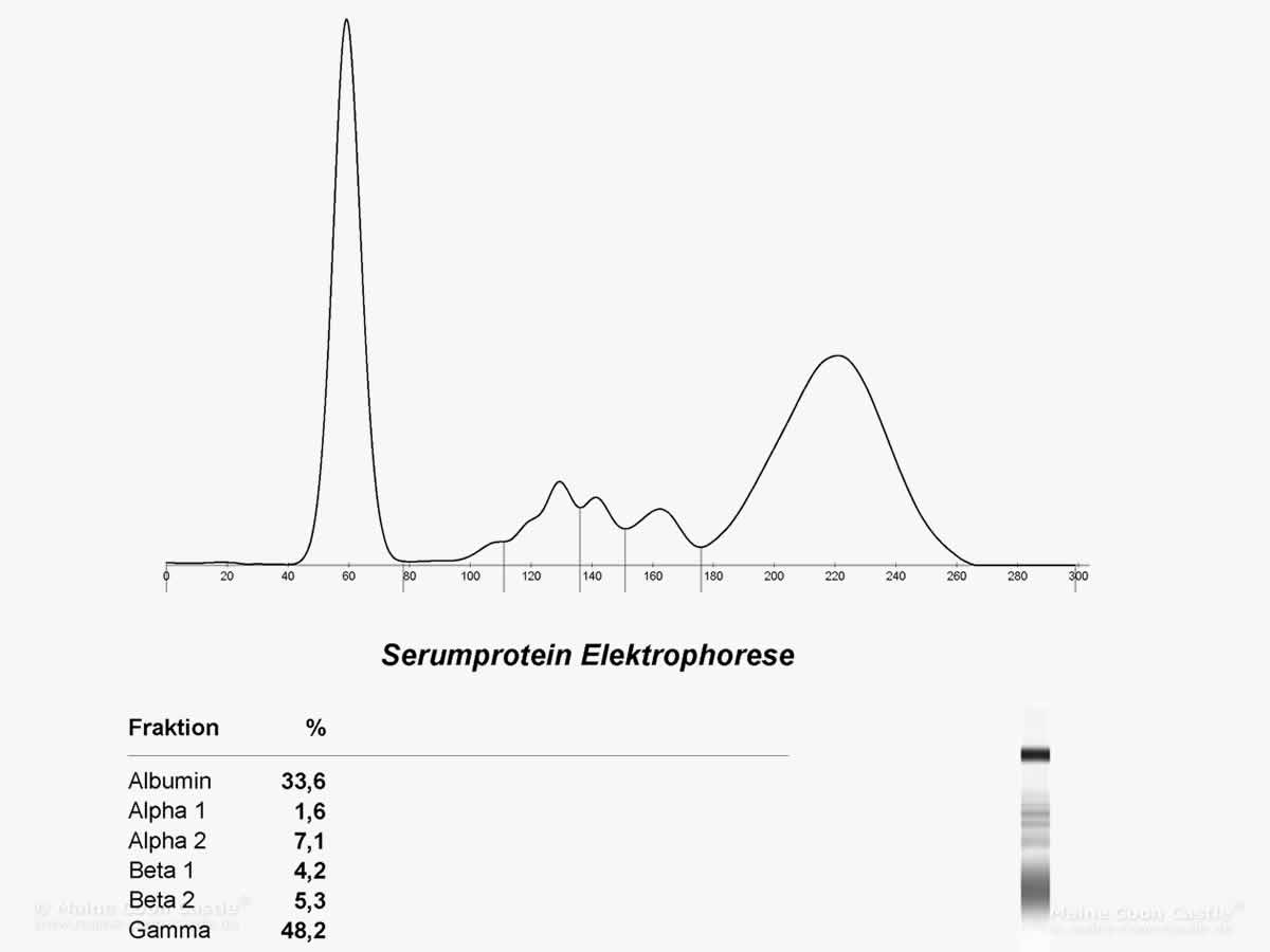 grafische Darstellung einer Serumprotein Elektrophorese